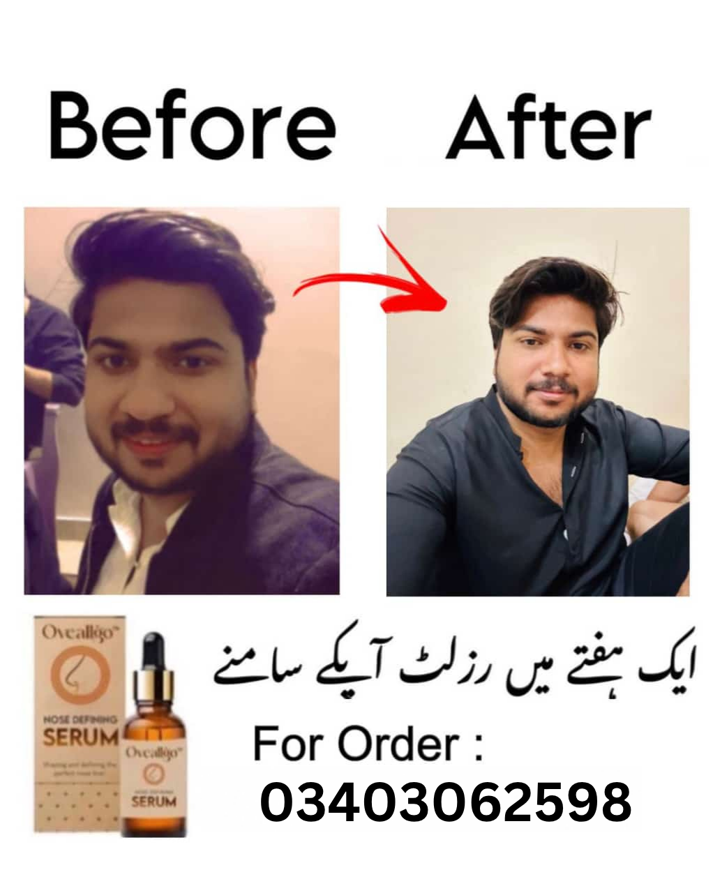 Nose Defining Serum